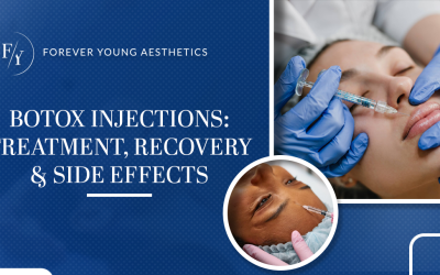 Botox Injections: Treatment, Recovery & Side Effects
