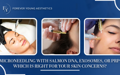 Microneedling with Salmon DNA, Exosomes, or PRP: Which Is Right for Your Skin Concerns?