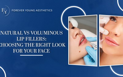 Natural vs. Voluminous Lip Fillers: Choosing the Right Look for Your Face