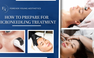How to Prepare for Microneedling Treatment