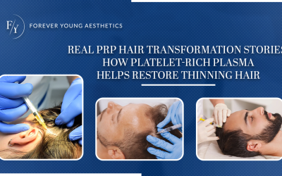 Real PRP Hair Transformation Stories: How Platelet-Rich Plasma Helps Restore Thinning Hair