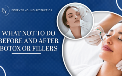 What Not to Do Before and After Botox or Fillers