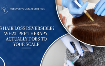 Is Hair Loss Reversible? What PRP Therapy Actually Does to Your Scalp (Part 1 of 2)