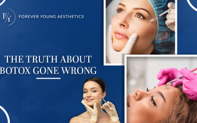 The Truth About Botox Gone Wrong (Part 1 of 2)