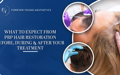 What to Expect from PRP Hair Restoration — Before, During & After Your Treatment (Part 2 of 2)