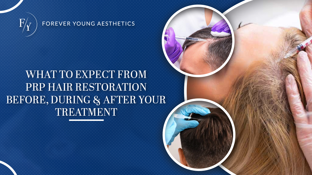 What to Expect from PRP Hair Restoration — Before, During & After Your Treatment (Part 2 of 2)