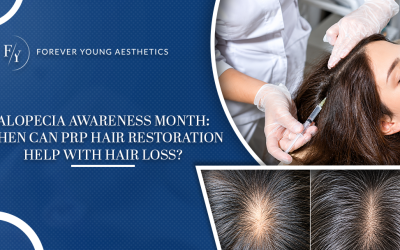 Alopecia Awareness Month: When Can PRP Hair Restoration Help with Hair Loss?