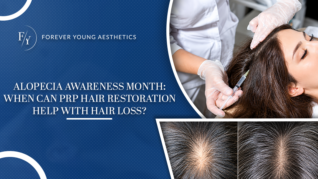 PRP hair restoration