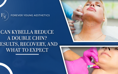 Can Kybella Reduce a Double Chin? Results, Recovery, and What to Expect