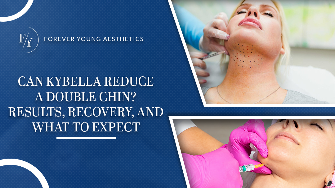 Kybella for double chin