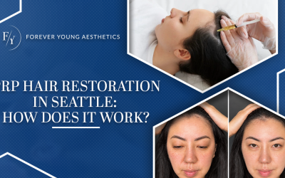 PRP Hair Restoration in Seattle: How Does It Work?