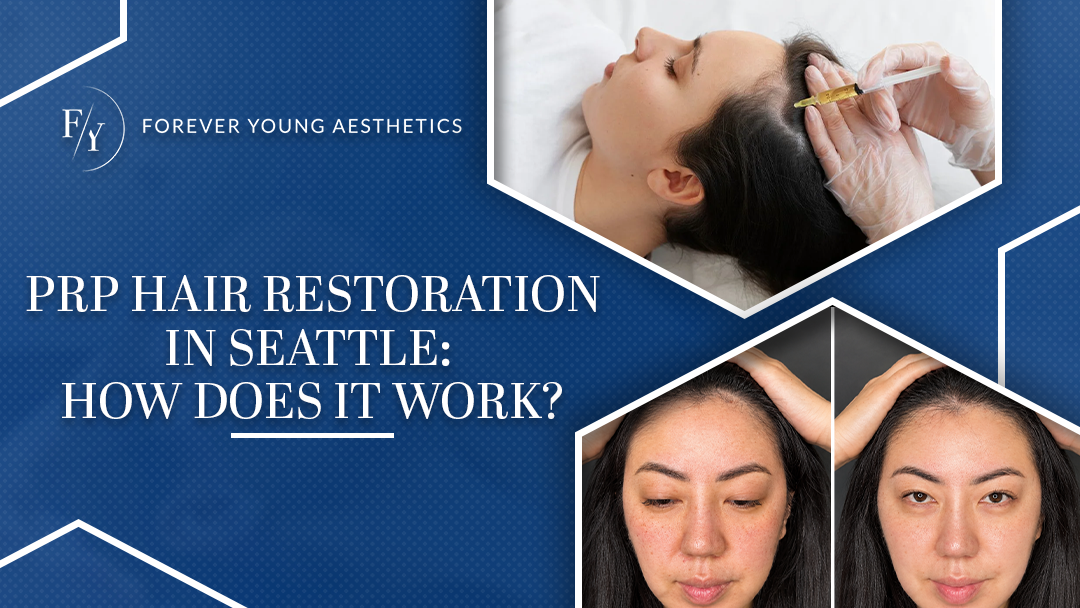 PRP hair restoration in Seattle